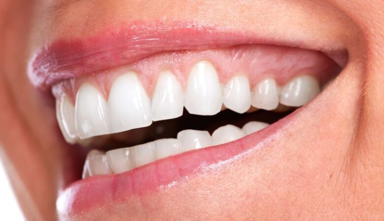 Gum Lifting: How to Restore Your Smile