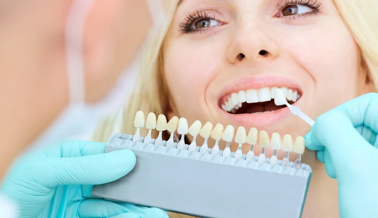 How Dentists Can Achieve the Best Teeth Whitening